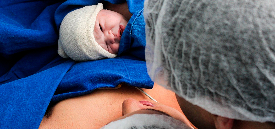 Минздрав: в Беларуси только 40 % родов проходят без осложнений