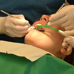 Заметки о стоматологах или как я ходила лечить зубы во время беременности